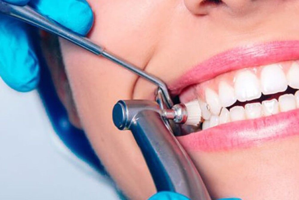 benefits-of-consistent-dental-cleanings-near-you benefits-of-consistent-dental-cleanings-near-you