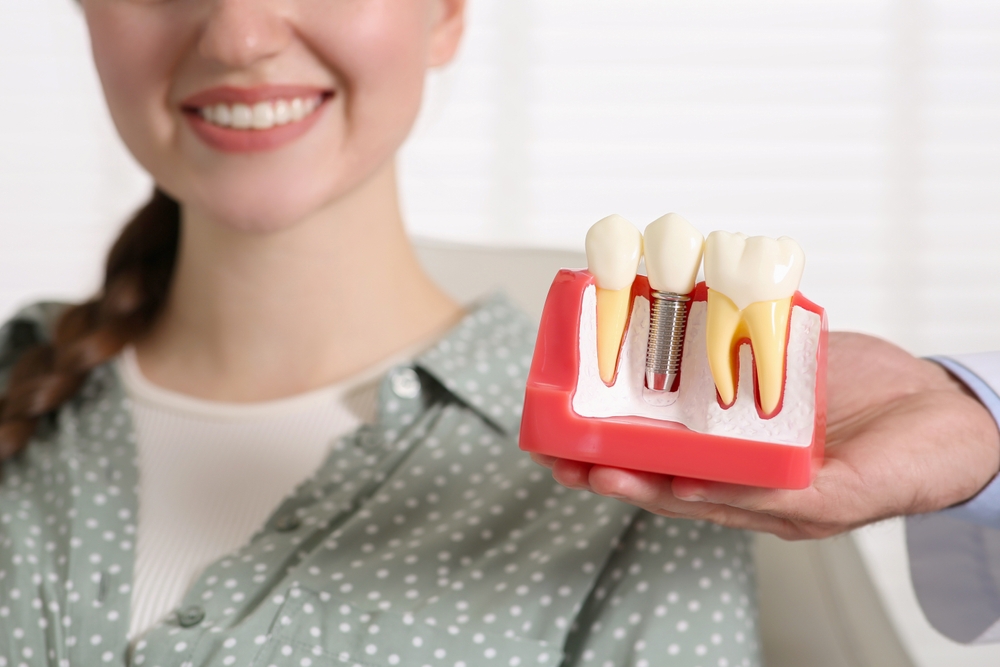 Doctor,With,Educational,Model,Of,Dental,Implant,Consulting,Patient,In Doctor,With,Educational,Model,Of,Dental,Implant,Consulting,Patient,In