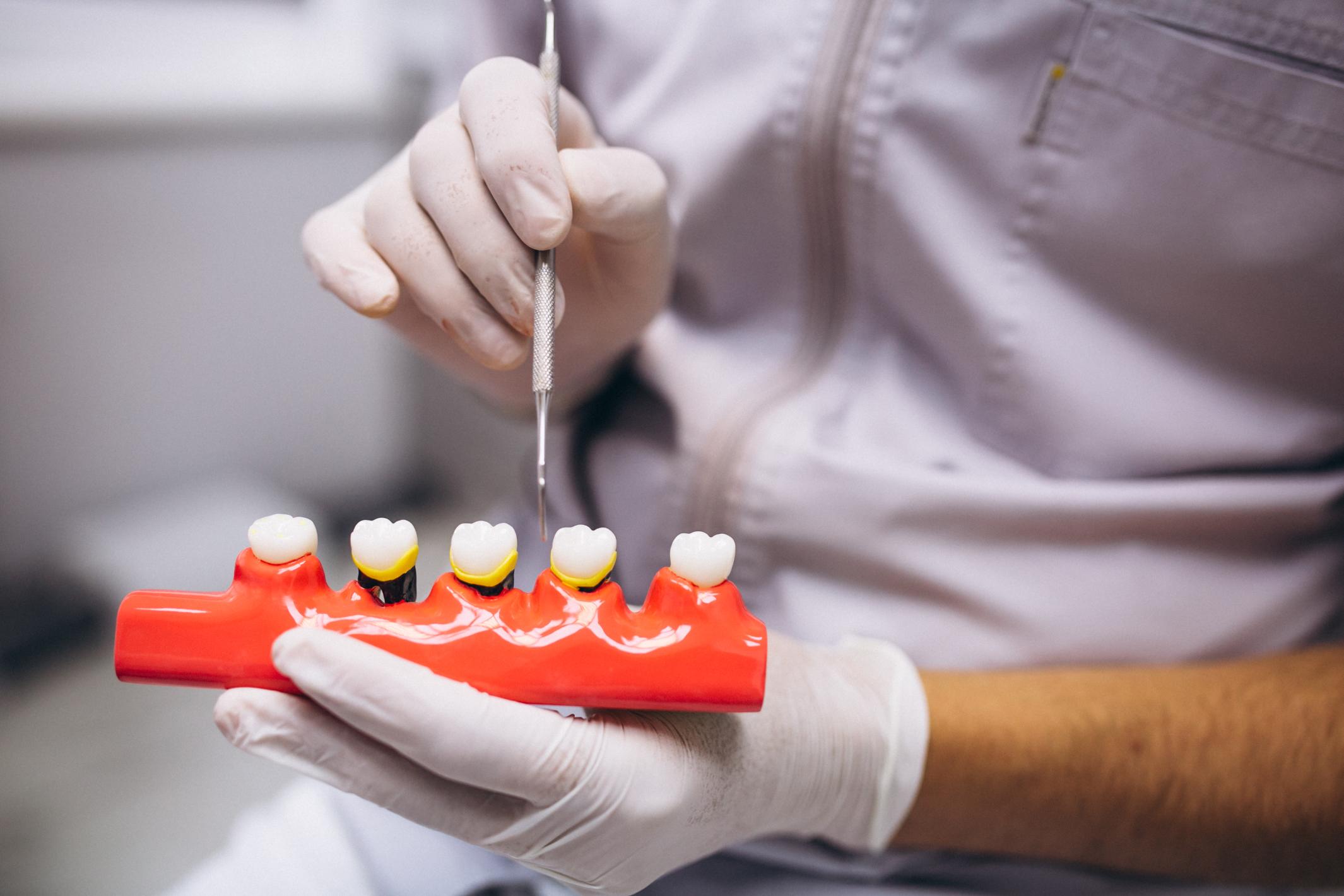 caring for your dental bridge near you caring for your dental bridge near you