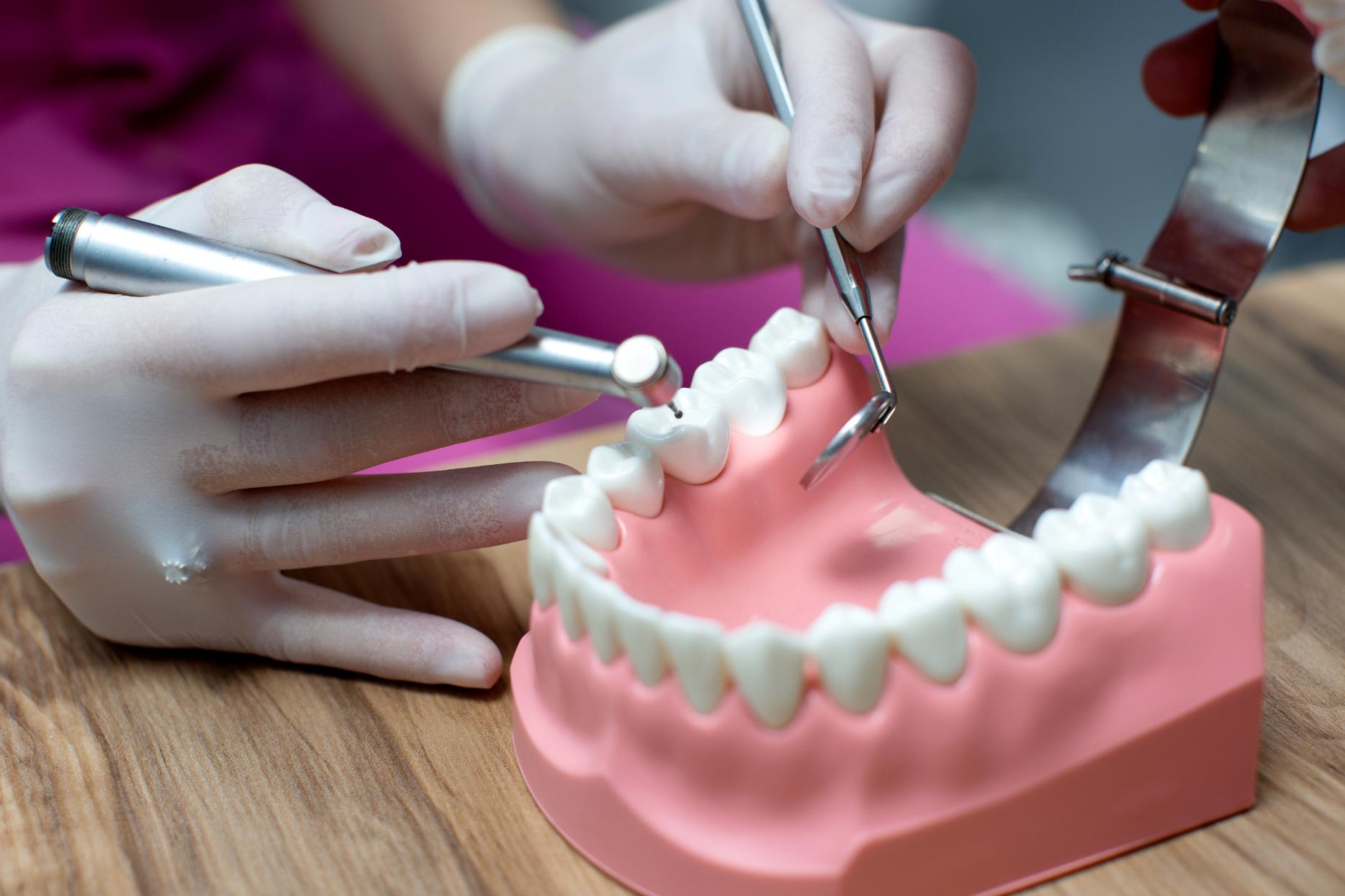 how dental bridges near you are placed how dental bridges near you are placed