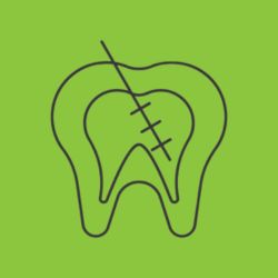 Root Canals