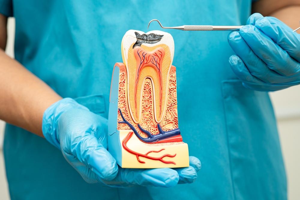 root canal therapy near you root canal therapy near you