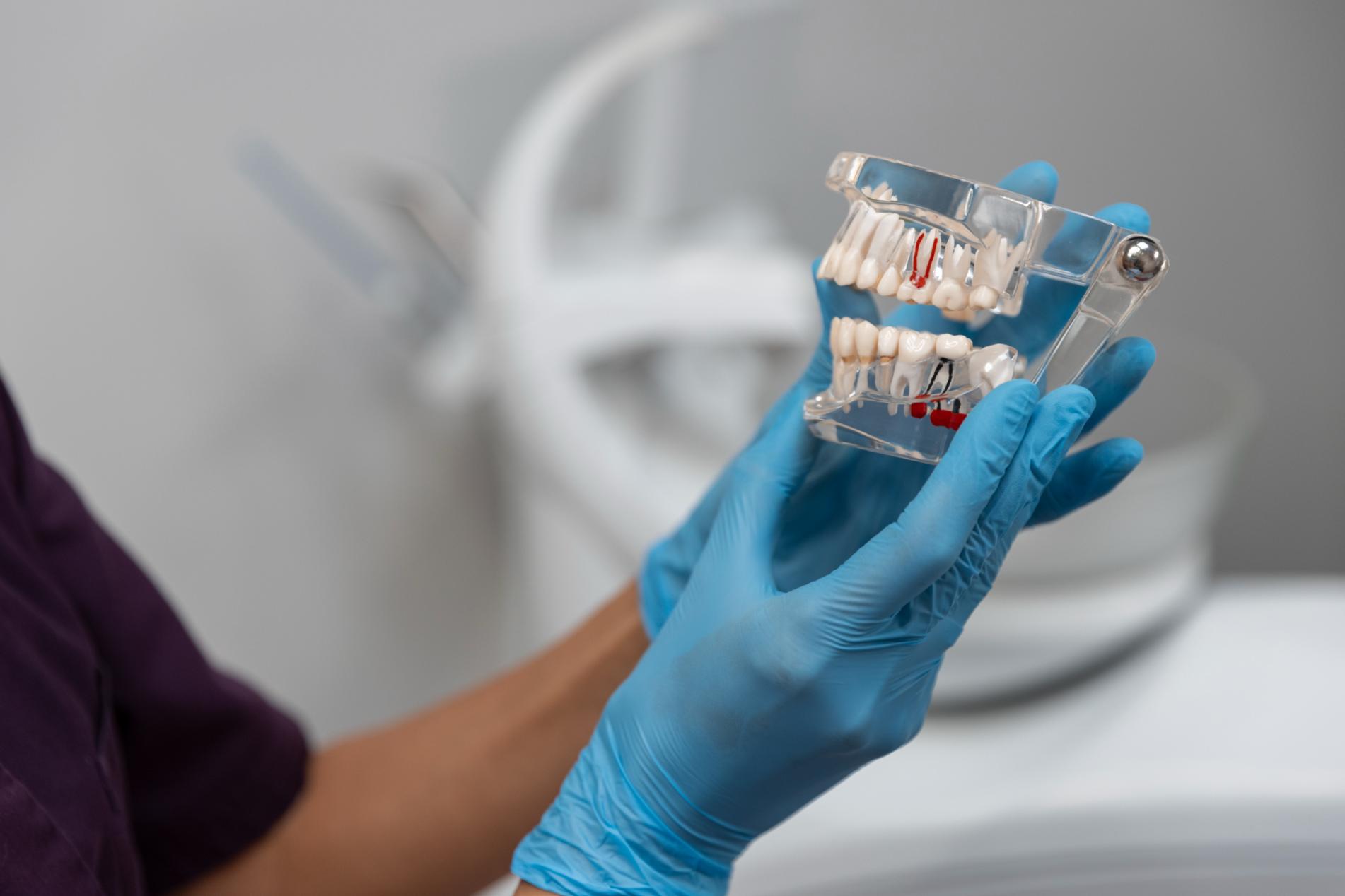 types of dental bridges in edmonton types of dental bridges in edmonton