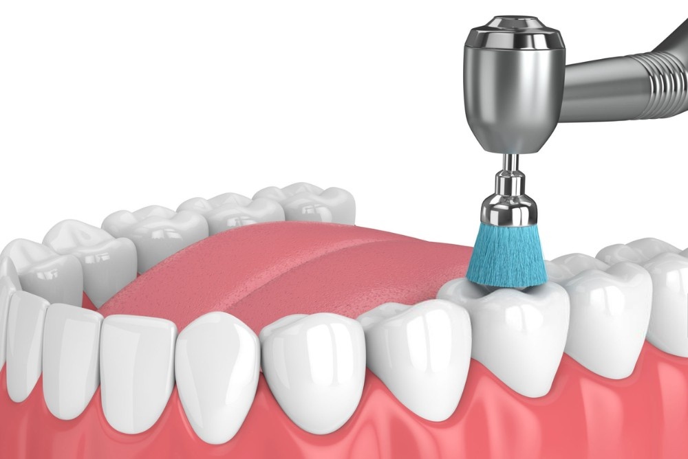 what-are-dental-cleanings-near-you what-are-dental-cleanings-near-you