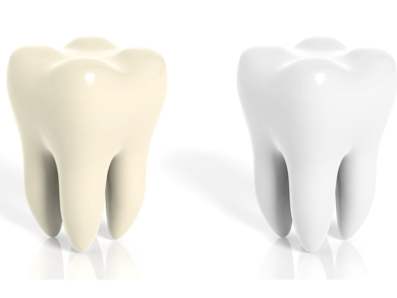 zoom teeth whitening edmonton zoom teeth whitening edmonton