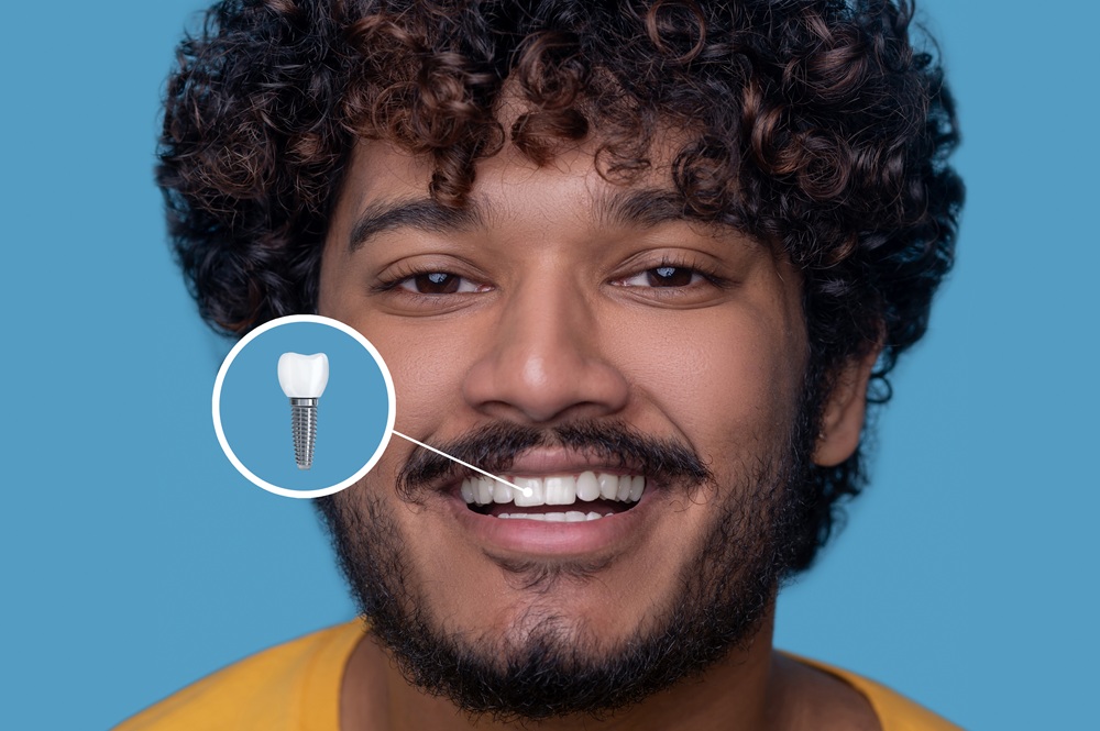 Do Dental Implants Look Natural?