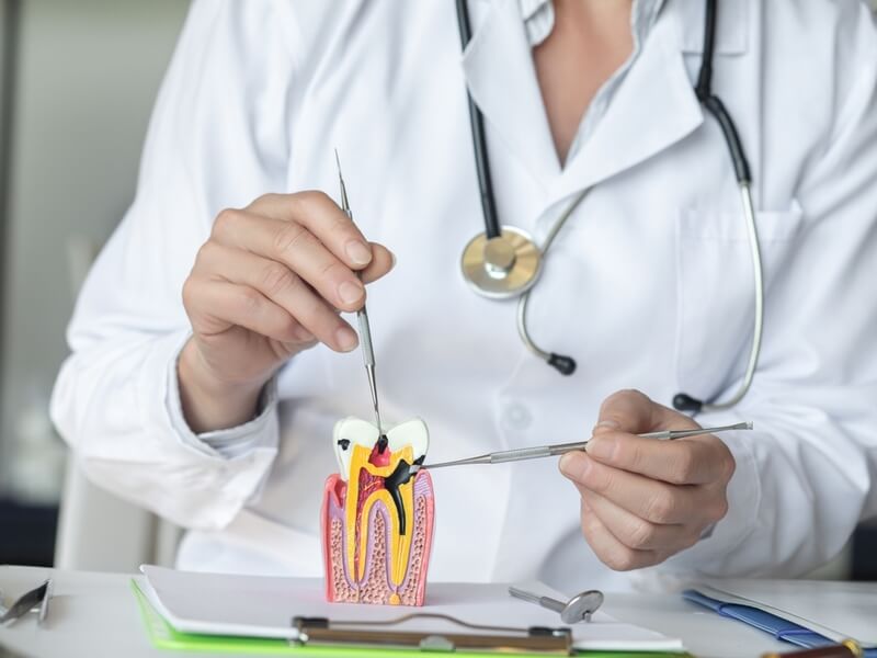 how long before i can eat normally after a root canal