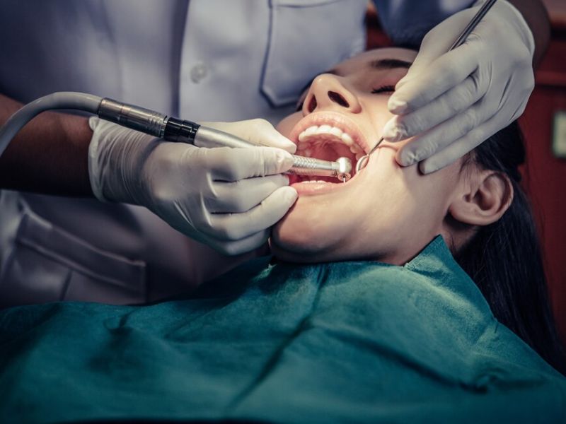 understanding root canal costs a breakdown
